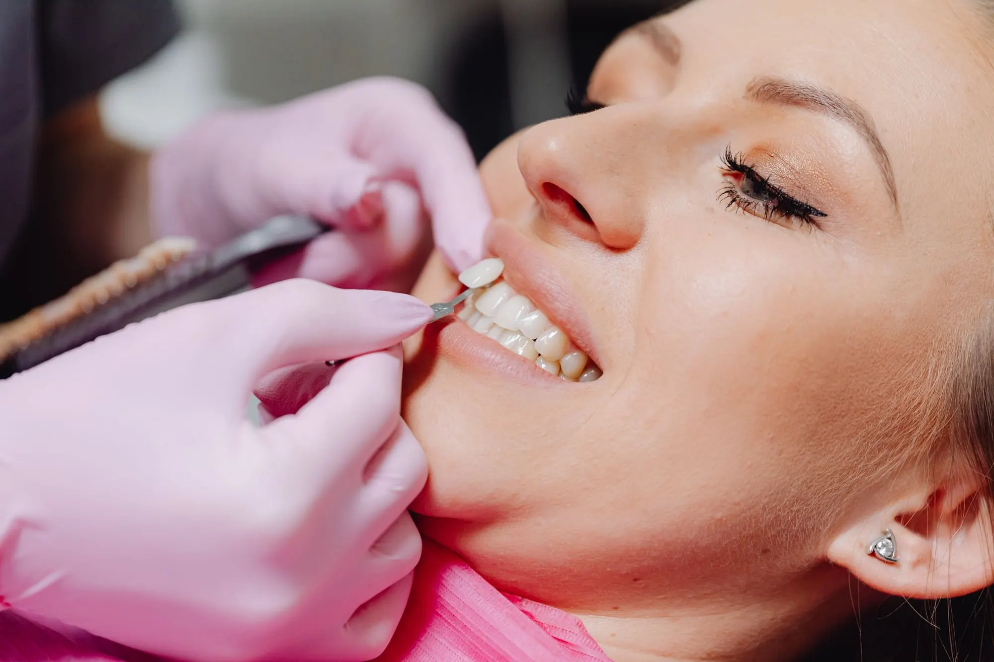 Dentist carrying out cosmetic bonding on front teeth
