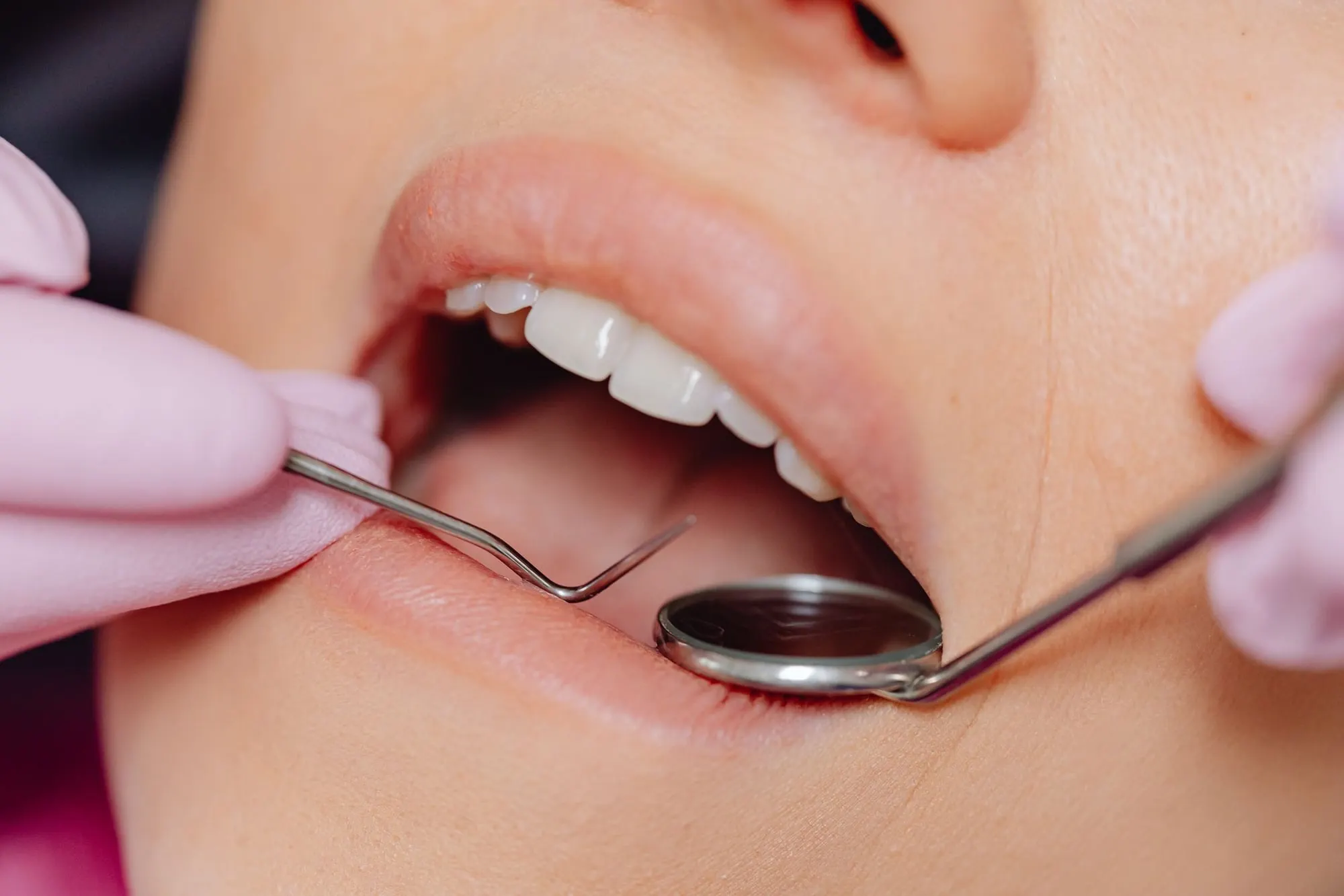 Dentist checking a patient’s gums with a mirror and probe