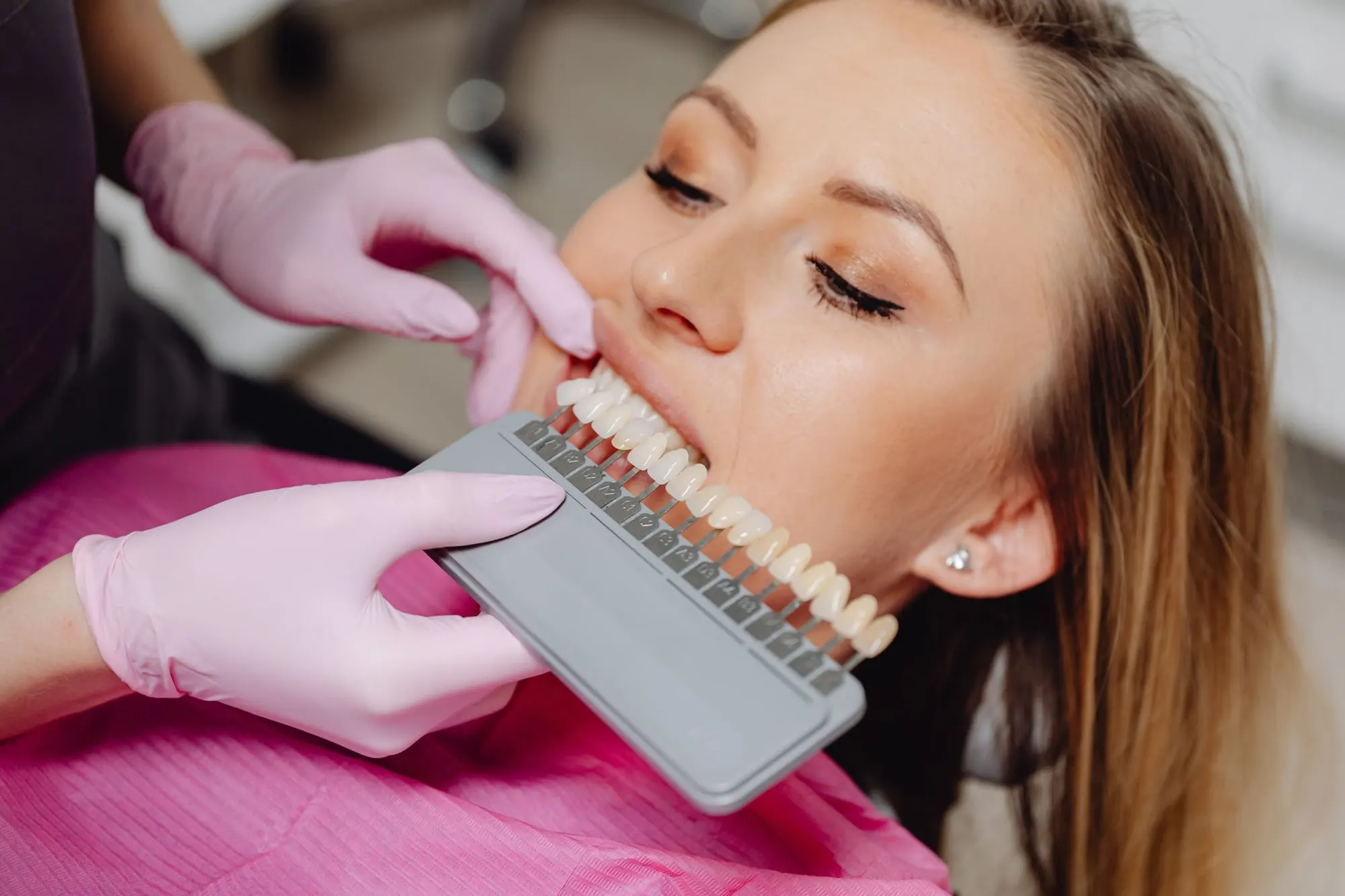 Dentist matching a veneer shade to a patient’s teeth